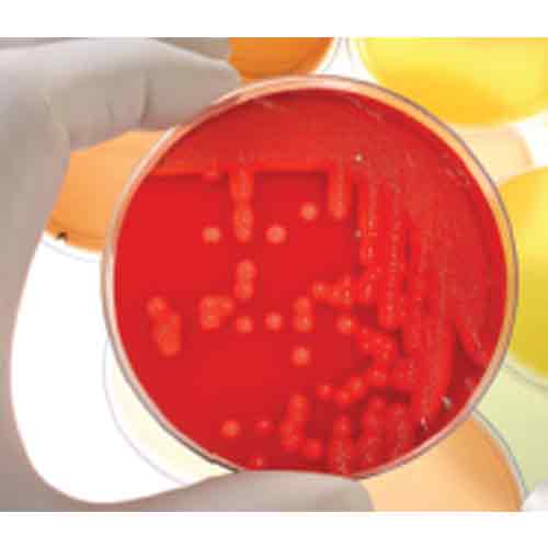 Pathogen Detection For Finished Good Products