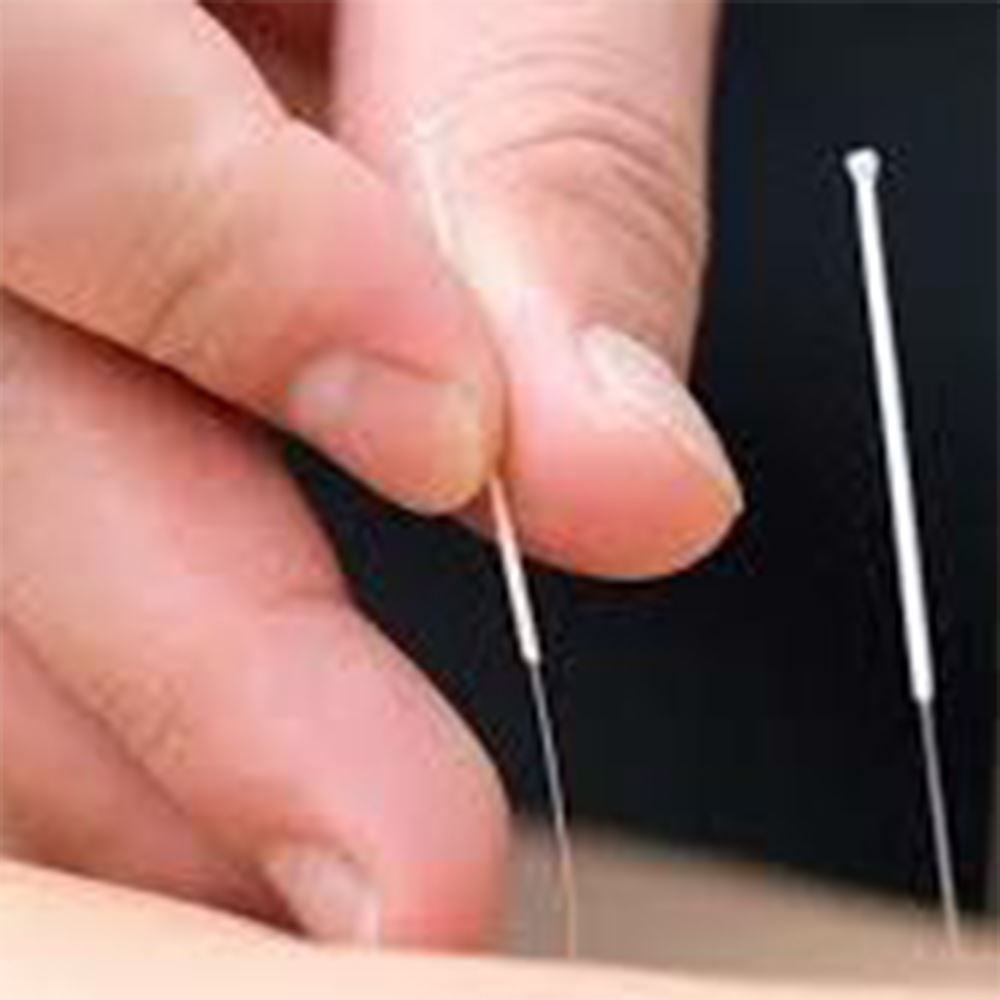 Basic Acupuncture (Akupunktur Asas)