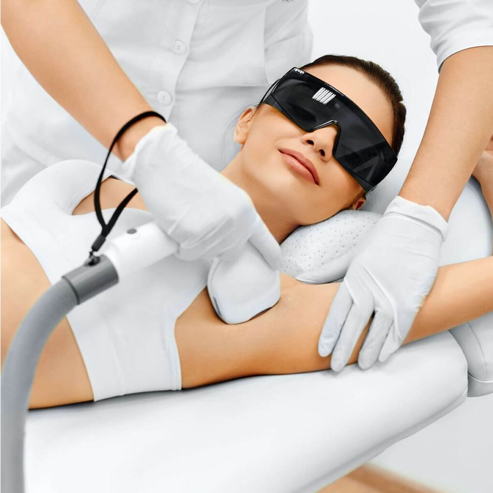 OPT Skin Laser Treatment