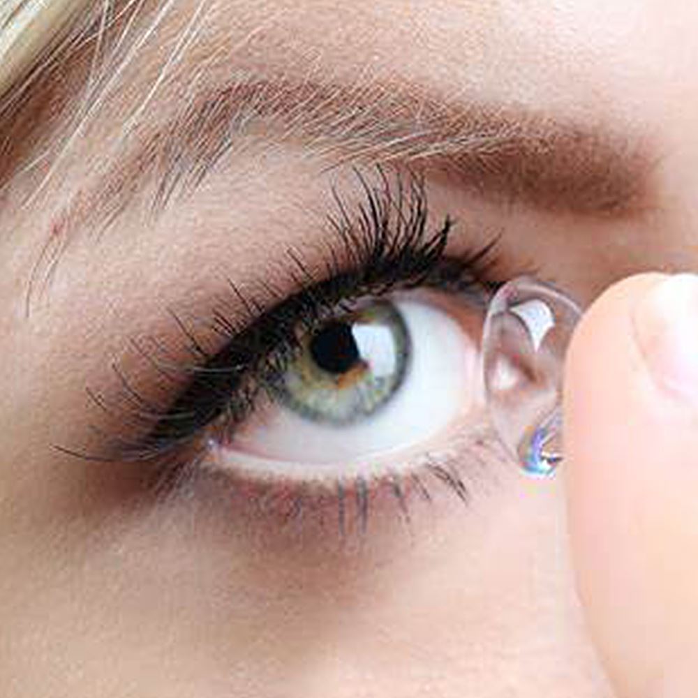 Contact Lens Fitting 